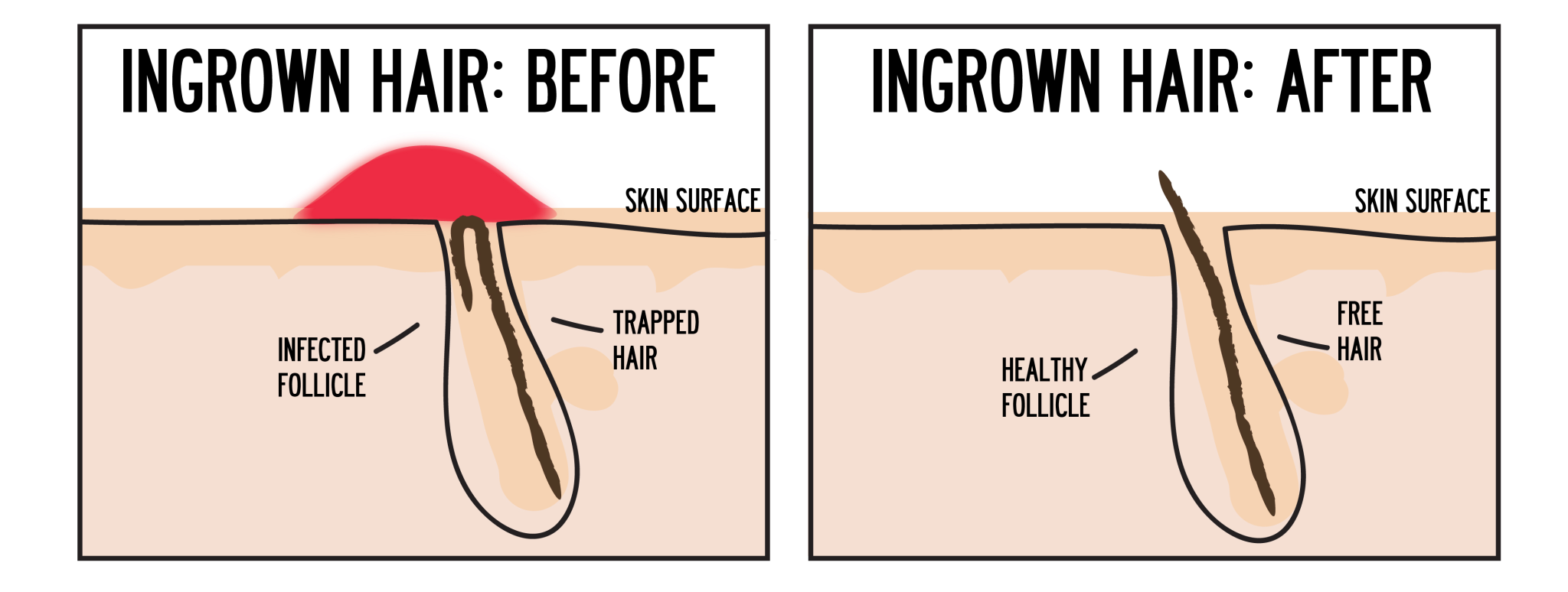 Waxing Melbourne Beautyologist Beauty Salon