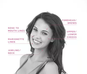 PDO THREAD LIFTS by Beautyologist in St Kilda