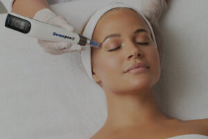 Skin Needling Treatment with Dermapen 4 by Beautyologist