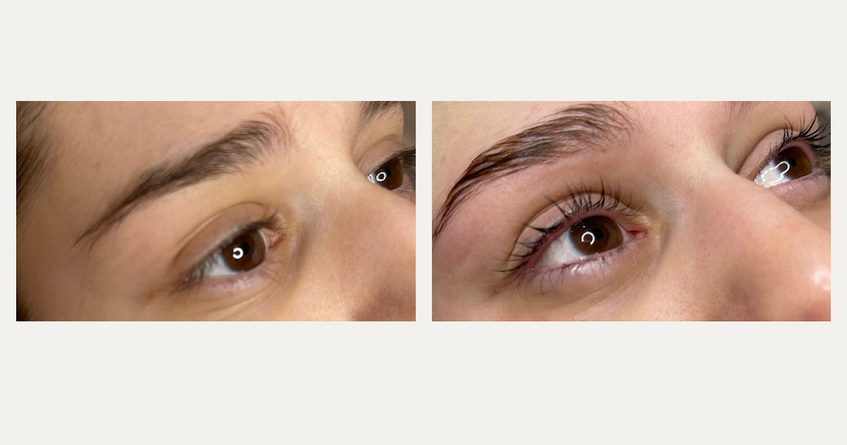 EYEBROW LAMINATION Treatments in Melbourne, VIC