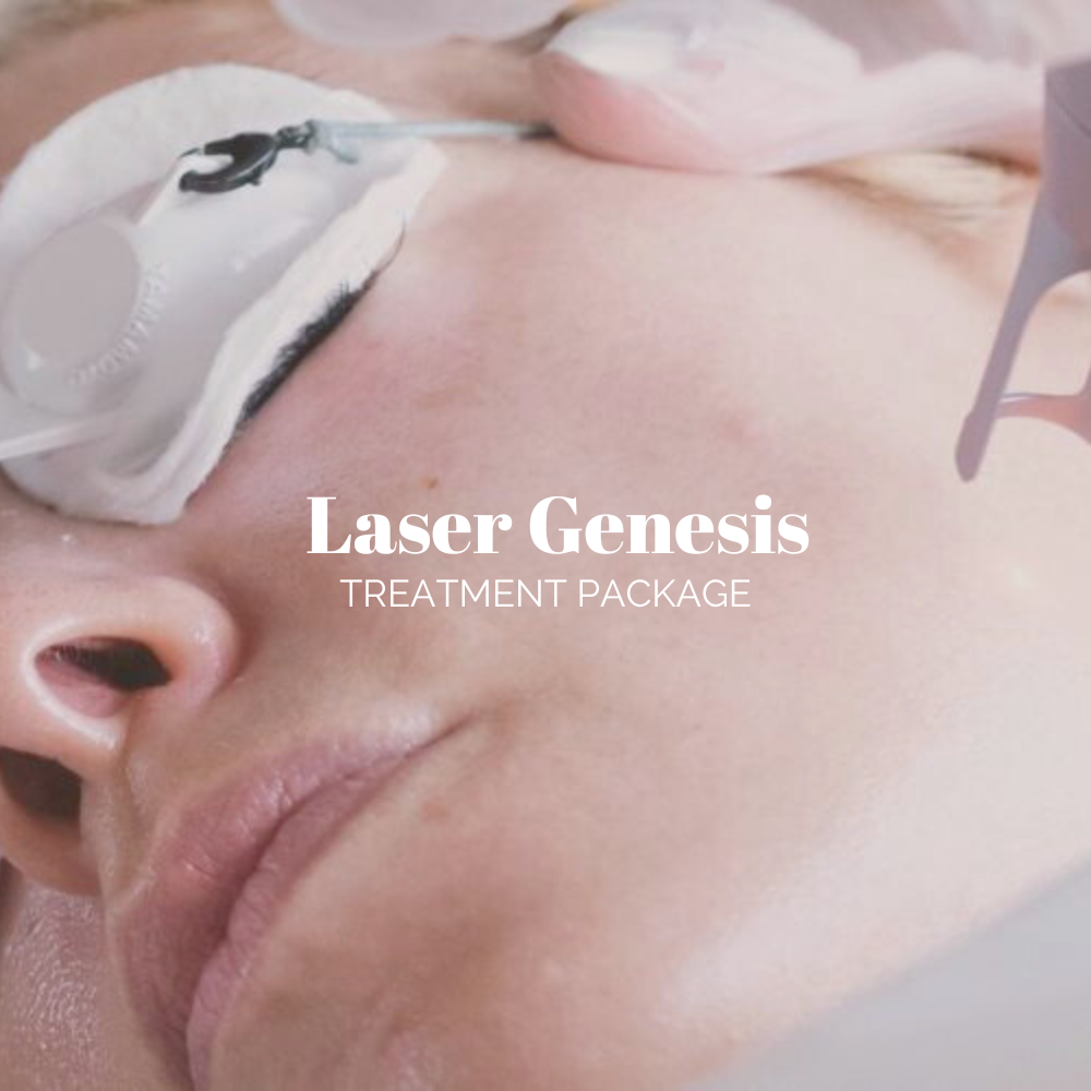Laser Genesis E-Voucher