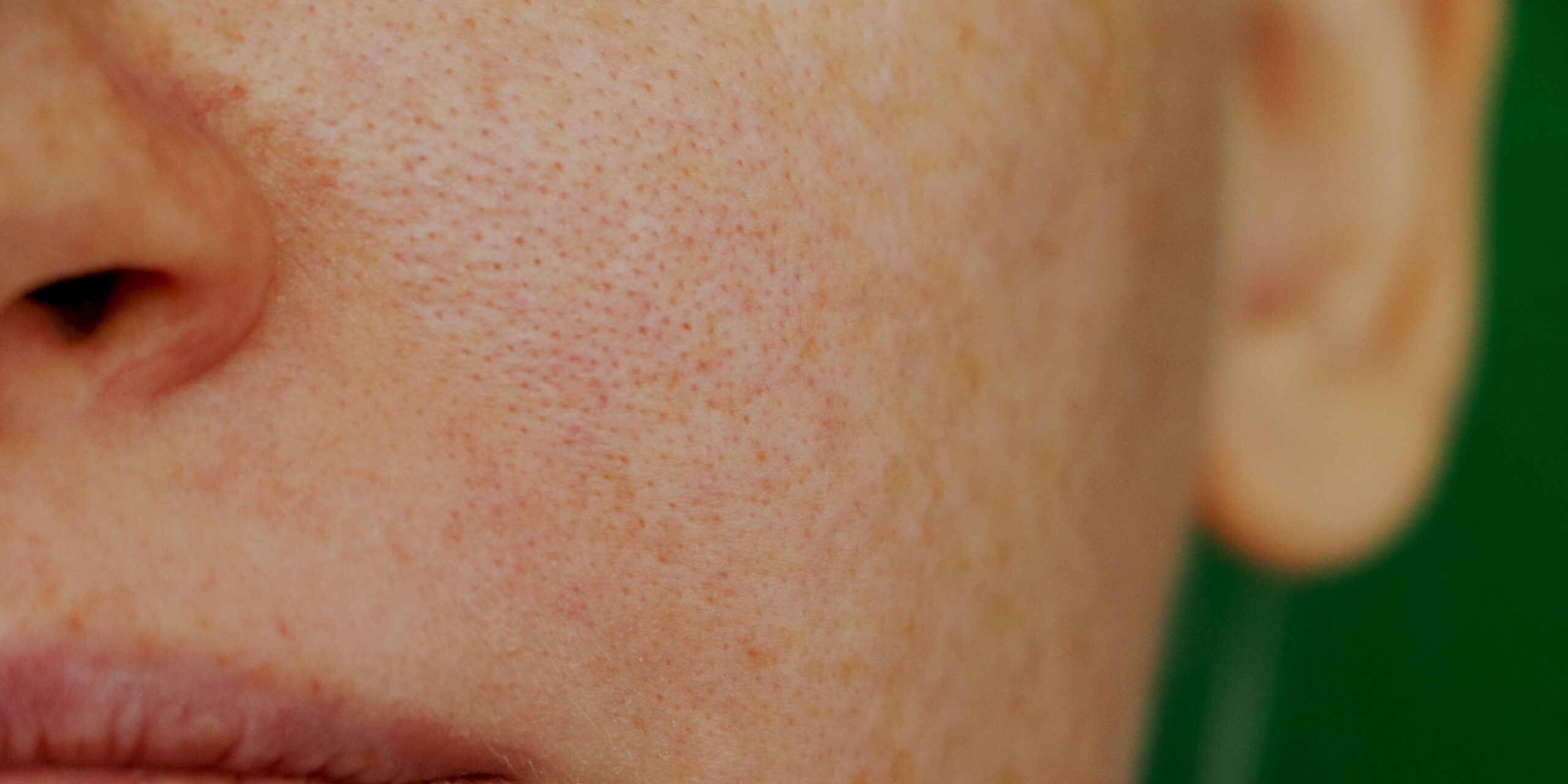Let’s Talk Pores: Why They Seem to Grow with Age (and What We Can Do About It).