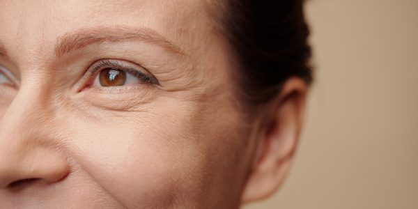 Eye Wrinkles Formation Face of smiling woman with forming eye wrinkles
