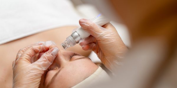 Beautician in gloves conducts vacuum cleaning and polishing face Beautician in gloves conducts vacuum cleaning and polishing face skin young woman in cosmetology clinic Professional moisturizing and rejuvenating hardware procedures for modern people